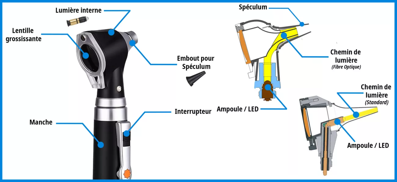 intérieur otoscope