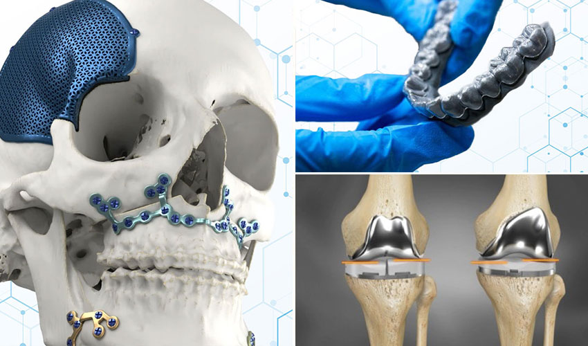 Illustrations impression 3D médicale